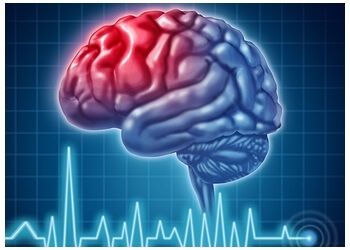 Photo of DR. BRANDON KUCHER, CONDITIONS TREATED:Dystonia, Inherited Neurological, Neuromuscular and Movement Disorders, Seizures, Parkinson Diseases, Neurogenetics, Chronic Migraine &amp; Headaches in SAULT STE. MARIE