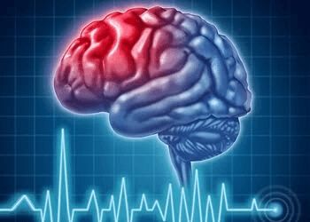 Photo of DR. GEORGE RICE, CONDITIONS TREATED:
Migraines, Back Pain, Bell&#x27;s Palsy, Guillain-Barre Syndrome, Headache, Alzheimer&#x27;s, Dementia, Huntington&#x27;s and Infectious Diseases, Cephalic &amp; Movement Disorders in LONDON