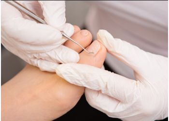 Photo of GARY MANTELL, CONDITIONS TREATED:Bunions, Flatfeet, Foot Orthotics, Fungal Toenails, Fractures of the Ankle, Hallux Rigidus, Hammertoes, Heel Pain, Ingrown Nails, Plantar Fasciitis, Plantar Warts &amp; Ankle Sprain in MEMPHIS