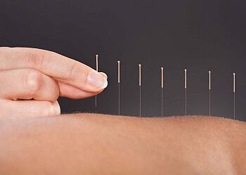 Photo of LYNNE DEAN, Acupuncture specialist